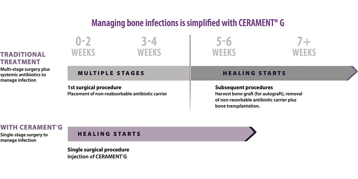 decor value managing bone infections simplified